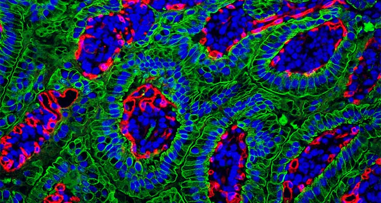 Image of immune cells